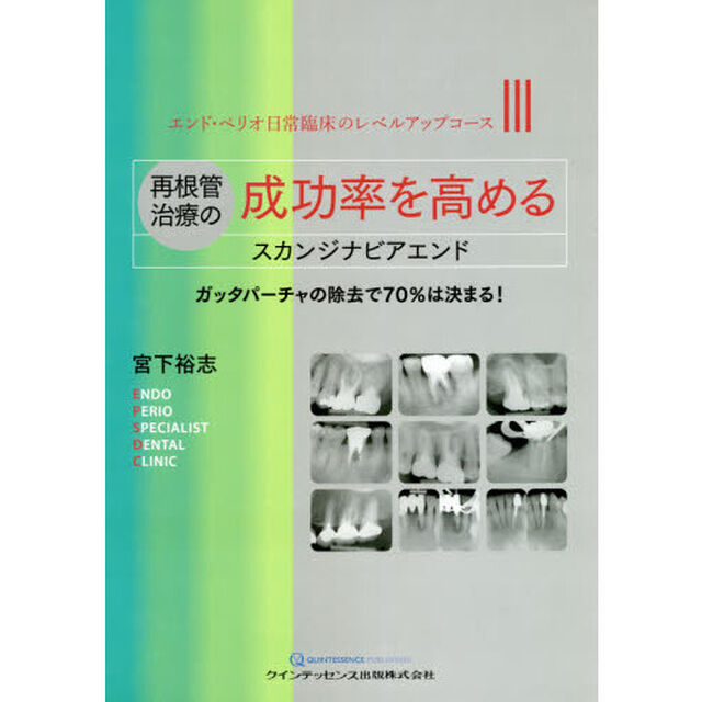 再根管治療の成功率を高めるスカンジナビアエンド　ガッタパーチャの除去で７０％は決まる！
