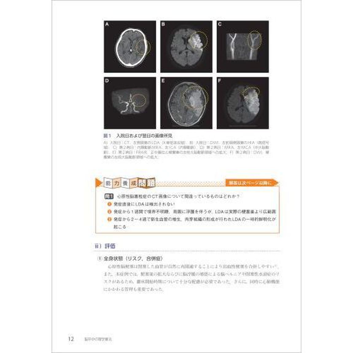 症例検討で身につける脳卒中の理学療法　エキスパートＰＴによる２０症例の臨床推論と効果的なリハプログラム