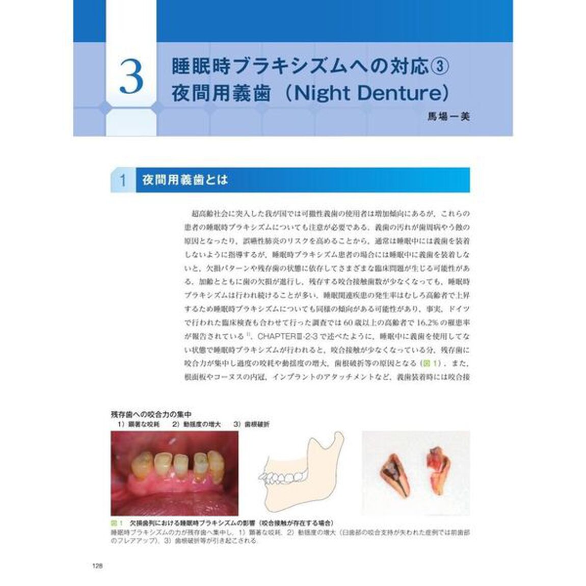 ブラキシズム完全読本