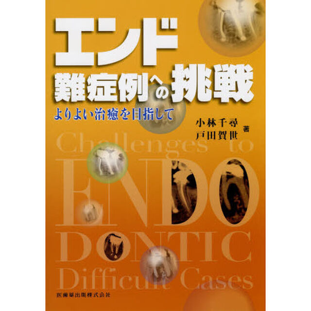 エンド難症例への挑戦　よりよい治癒を目指して