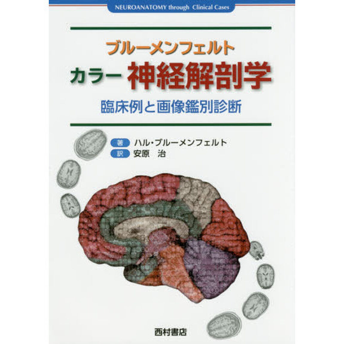 ブルーメンフェルト　カラー神経解剖学　臨床例と画像鑑別診断