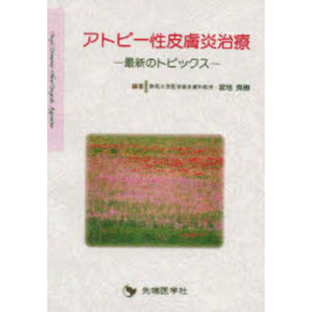 アトピー性皮膚炎治療　最新のトピックス