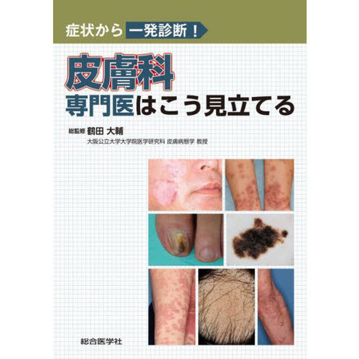 皮膚科専門医はこう見立てる　症状から一発診断！