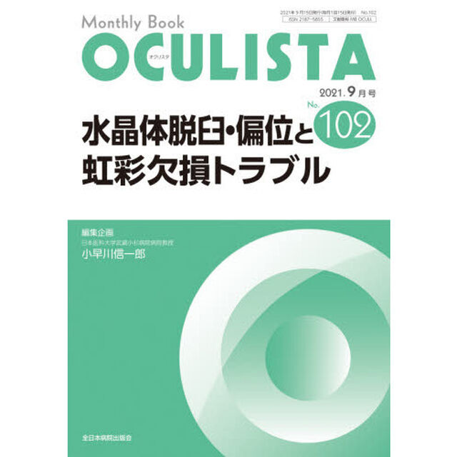 ＯＣＵＬＩＳＴＡ　Ｍｏｎｔｈｌｙ　Ｂｏｏｋ　Ｎｏ．１０２（２０２１．９月号）「水晶体脱臼・偏位と虹彩欠損トラブル」