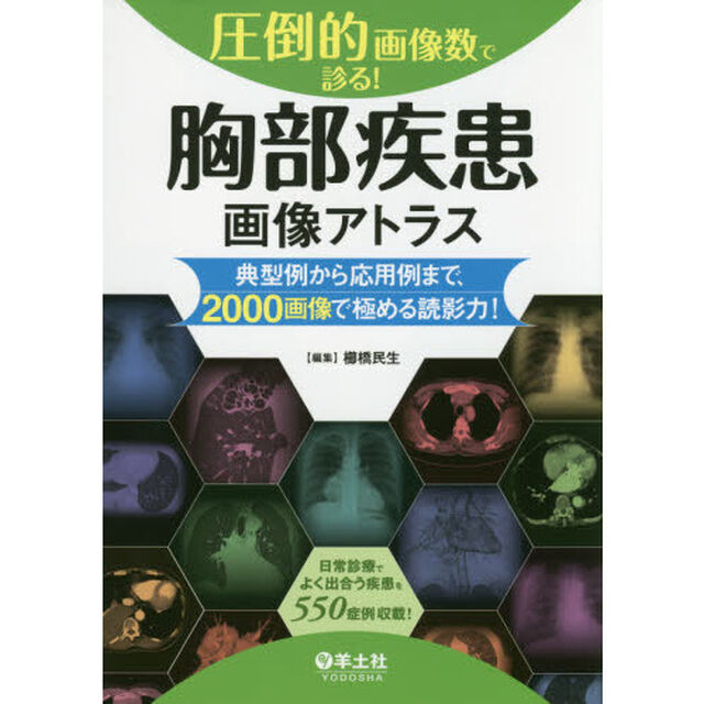 圧倒的画像数で診る！胸部疾患画像アトラス　典型例から応用例まで、２０００画像で極める読影力！