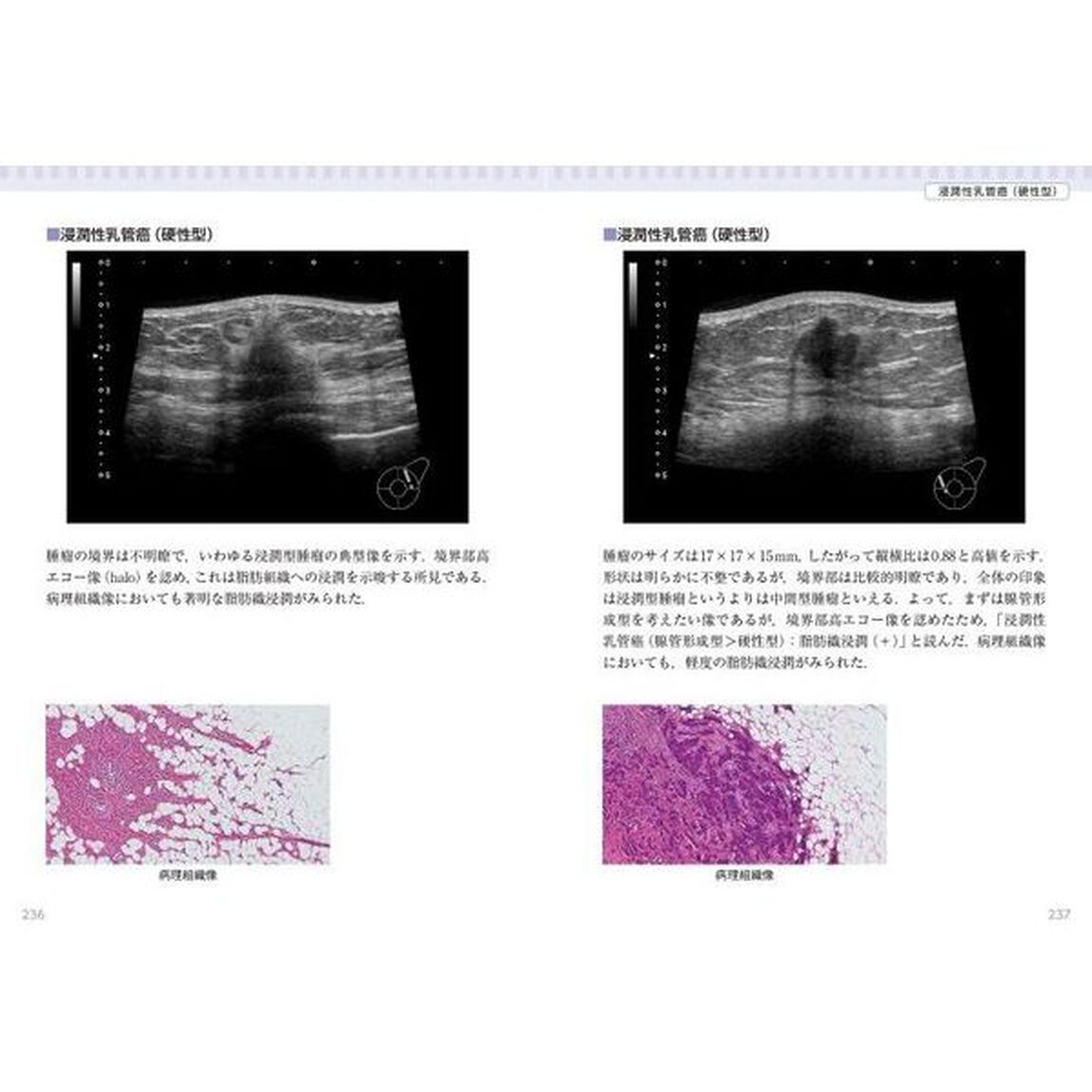 乳房アトラス「第４版」