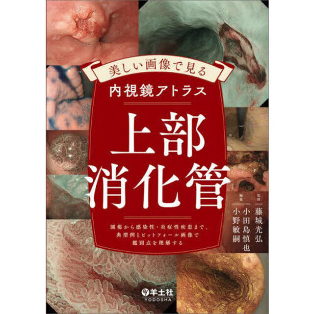 美しい画像で見る内視鏡アトラス上部消化管　腫瘍から感染性・炎症性疾患まで、典型例とピットフォール画像で鑑別点を理解する