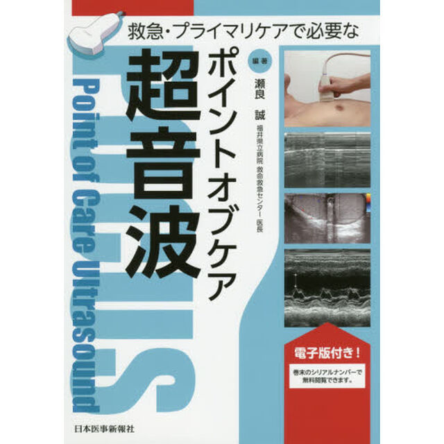 救急・プライマリケアで必要なポイントオブケア超音波　ＰＯＣＵＳ
