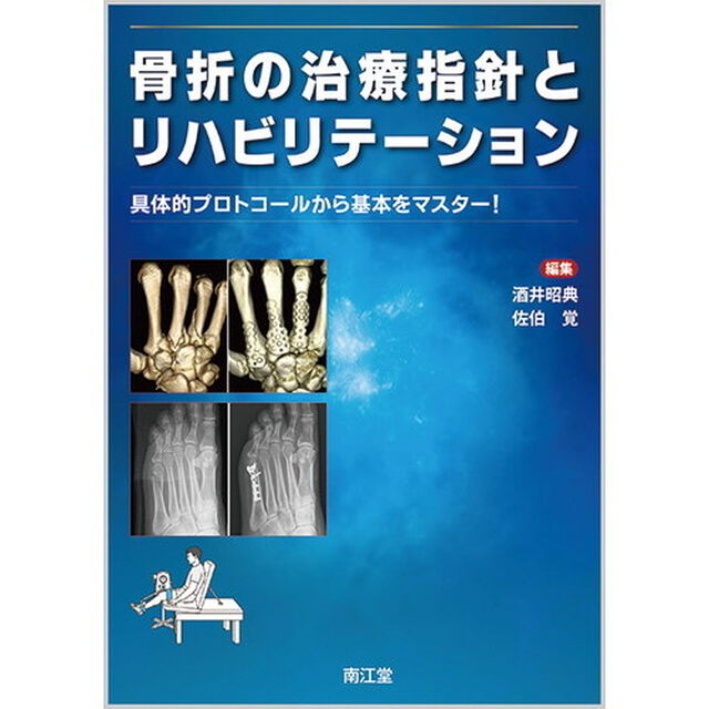 骨折の治療指針とリハビリテーション　具体的プロトコールから基本をマスター！
