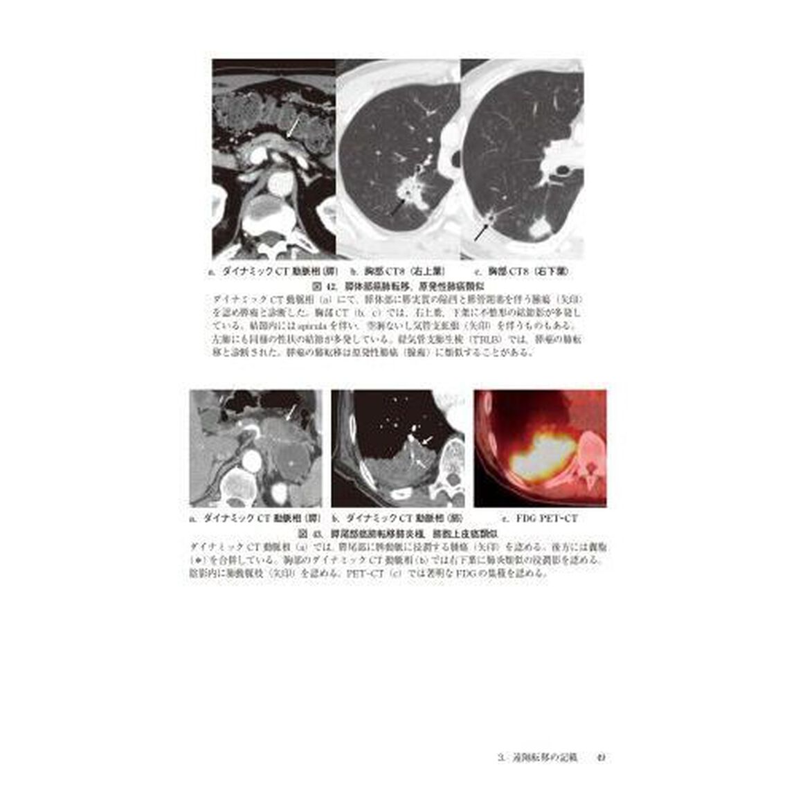 膵癌取扱い規約「第８版」