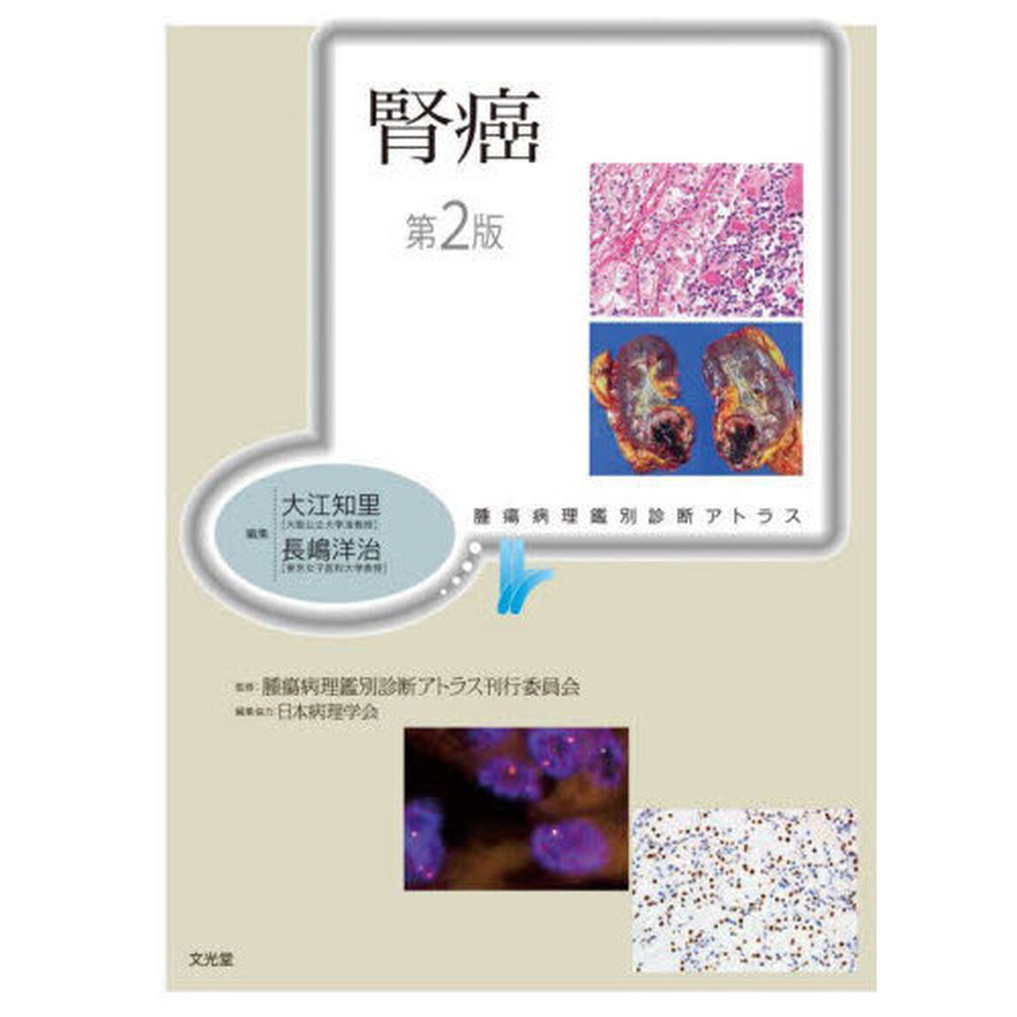 腎癌「第２版」