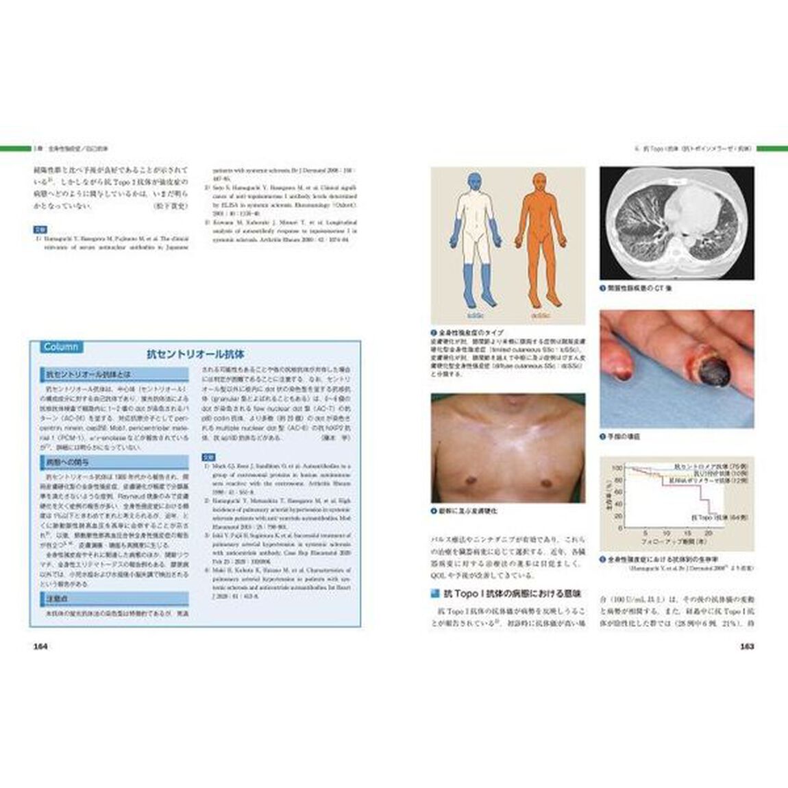 皮膚科膠原病　皮診から全身を診る