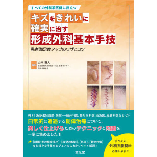 キズをきれいに確実に治す形成外科基本手技　すべての外科系医師に役立つ　患者満足度アップのワザとコツ
