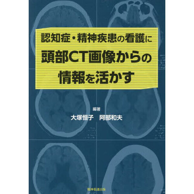 認知症・精神疾患の看護に頭部ＣＴ画像からの情報を活かす