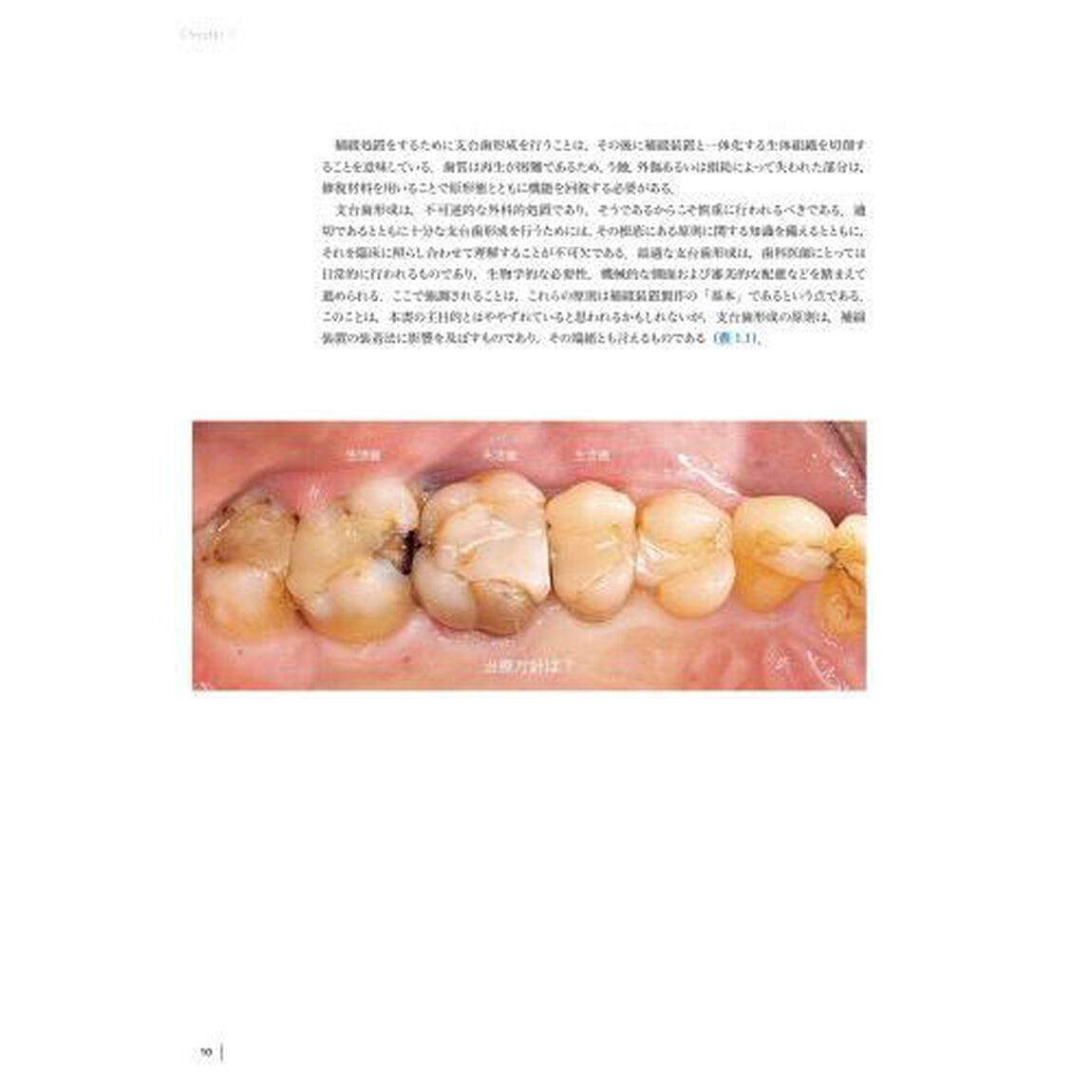 接着の科学　補綴装置装着のエビデンス＆テクニック