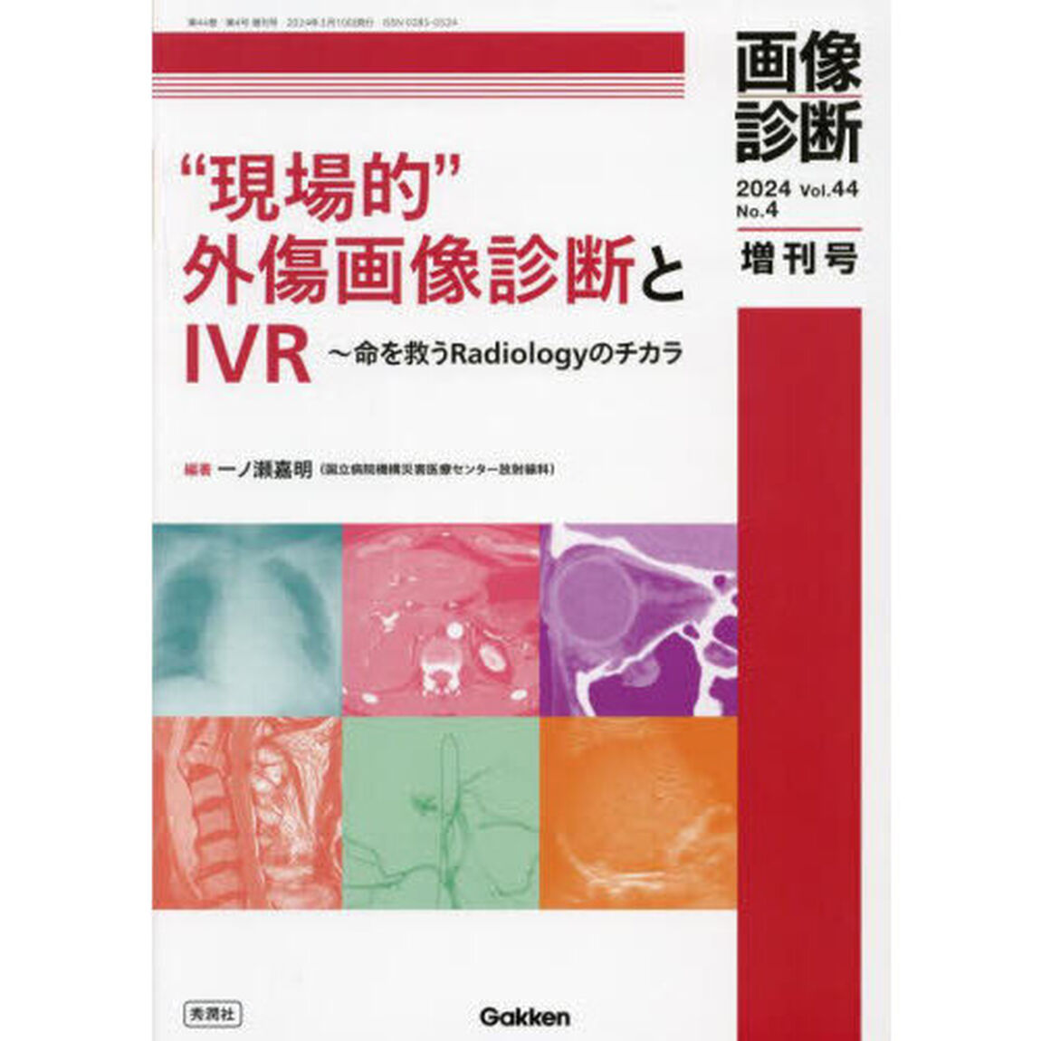 &ldquo;現場的&rdquo;外傷画像診断とＩＶＲ　命を救うＲａｄｉｏｌｏｇｙのチカラ