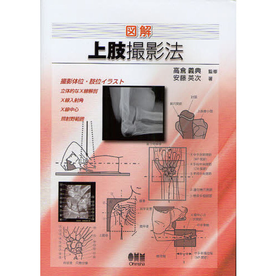 図解上肢撮影法