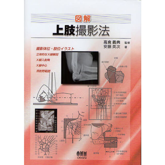 図解上肢撮影法