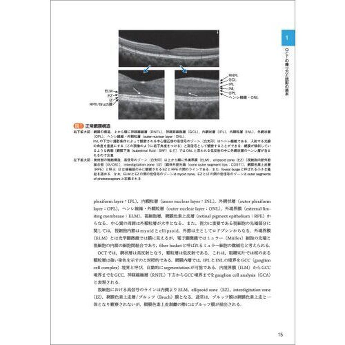 診断力がアップする！ＯＣＴ・ＯＣＴＡパーフェクト読影法　正常・異常所見の読み方と目のつけどころ