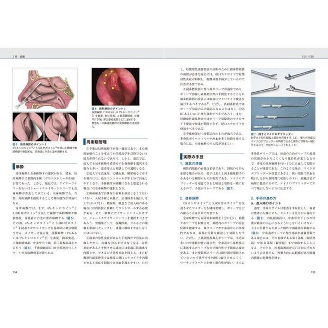 プラクティス耳鼻咽喉科の臨床　２「耳鼻咽喉科外来処置・外来手術最新マニュアル」