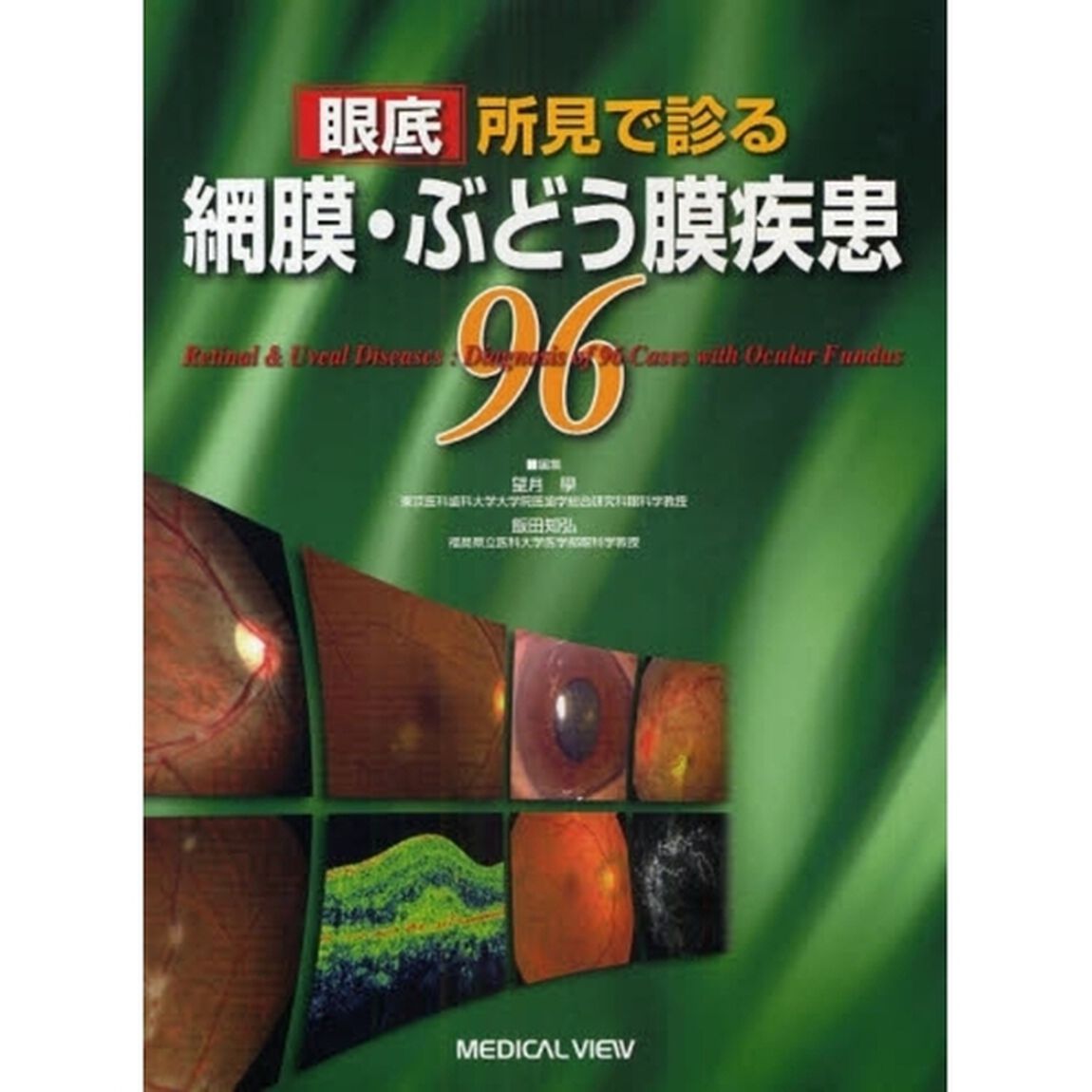 眼底所見で診る網膜・ぶどう膜疾患９６