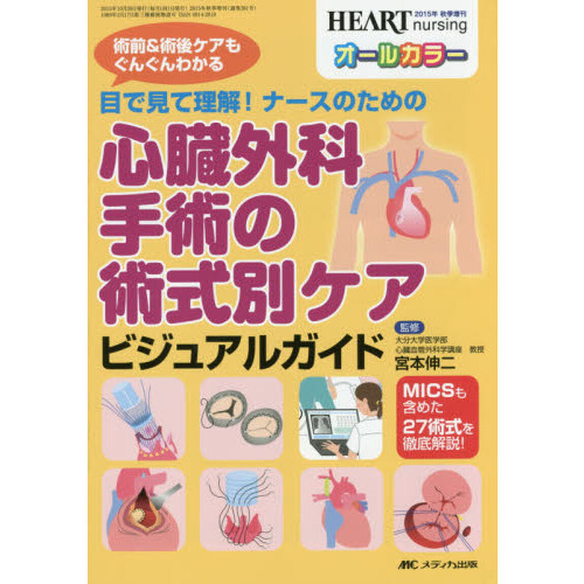 目で見て理解！ナースのための心臓外科手術の術式別ケアビジュアルガイド　術前＆術後ケアもぐんぐんわかる　ＭＩＣＳも含めた２７術式を徹底解説！　オールカラー