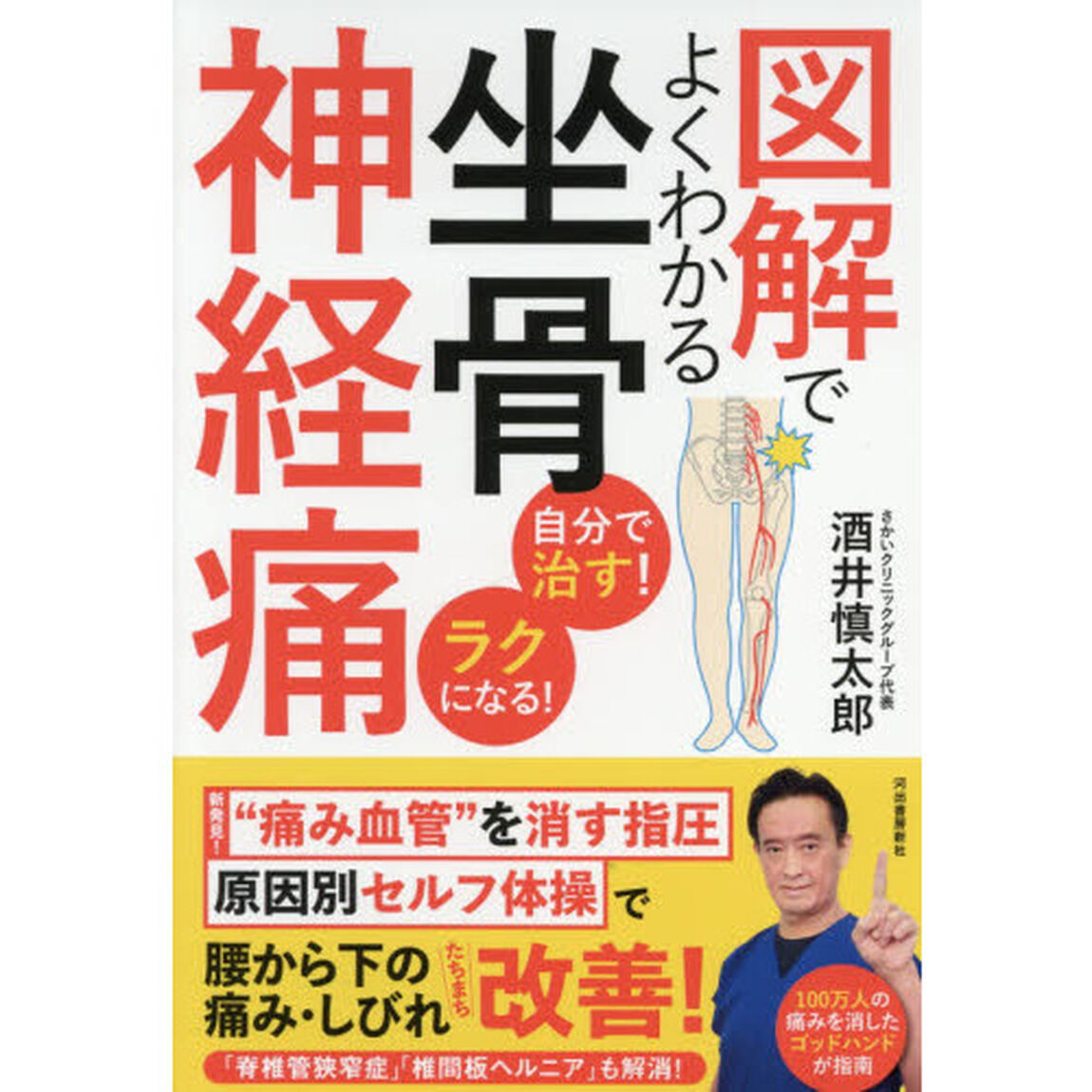 図解でよくわかる坐骨神経痛　自分で治す！ラクになる！