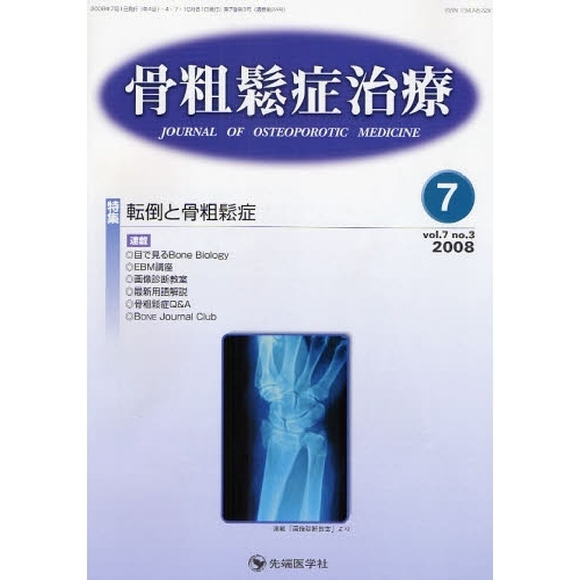 骨粗鬆症治療　ｖｏｌ．７ｎｏ．３（２００８－７）「特集転倒と骨粗鬆症」