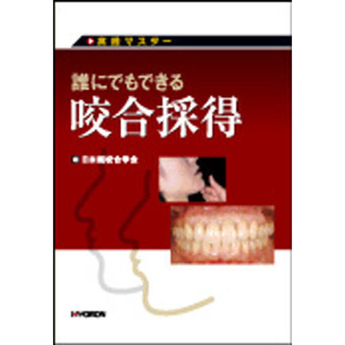 誰にでもできる　咬合採得