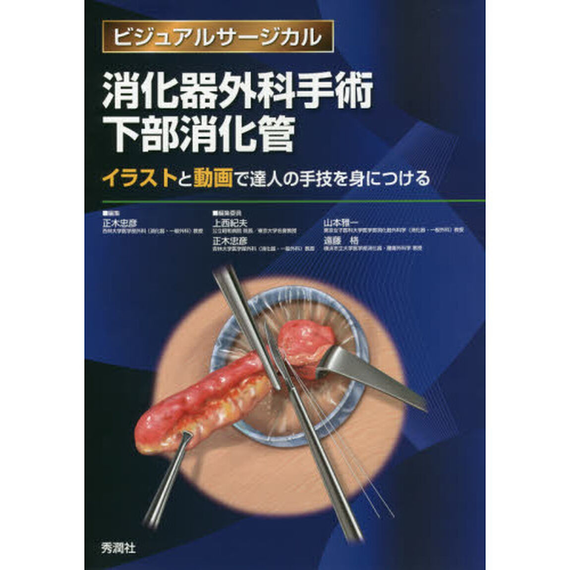 消化器外科手術下部消化管　イラストと動画で達人の手技を身につける