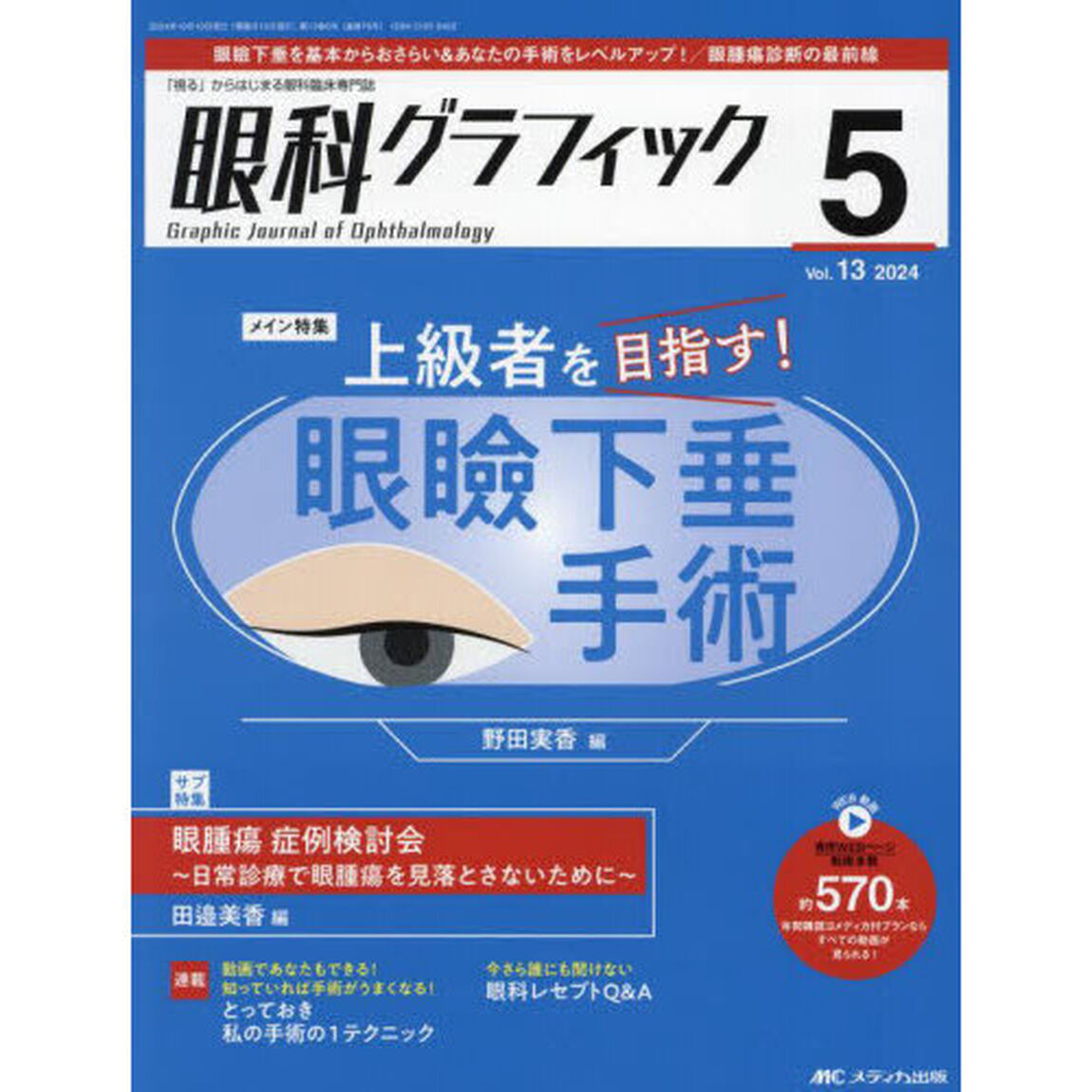 眼科グラフィック　「視る」からはじまる眼科臨床専門誌　第１３巻５号（２０２４）「上級者を目指す！眼瞼下垂手術」