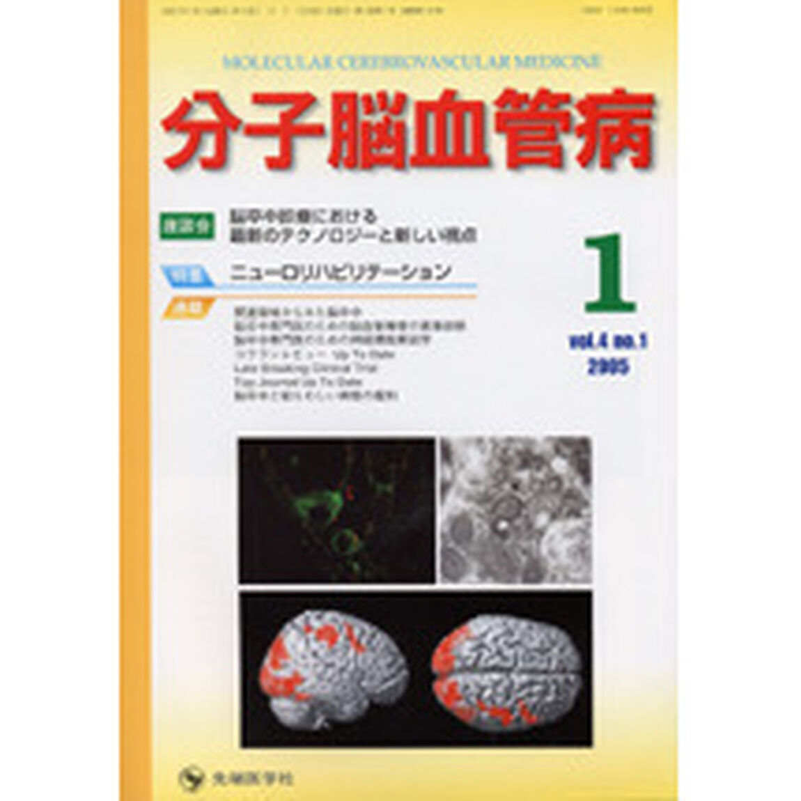 分子脳血管病　Ｖｏｌ．４Ｎｏ．１（２００５－１）「特集・ニューロリハビリテーション」
