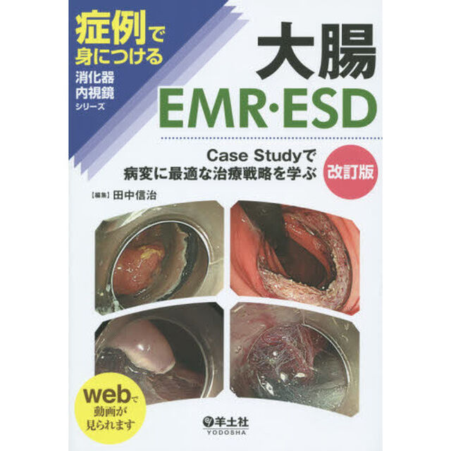 大腸ＥＭＲ・ＥＳＤ　Ｃａｓｅ　Ｓｔｕｄｙで病変に最適な治療戦略を学ぶ「改訂版」