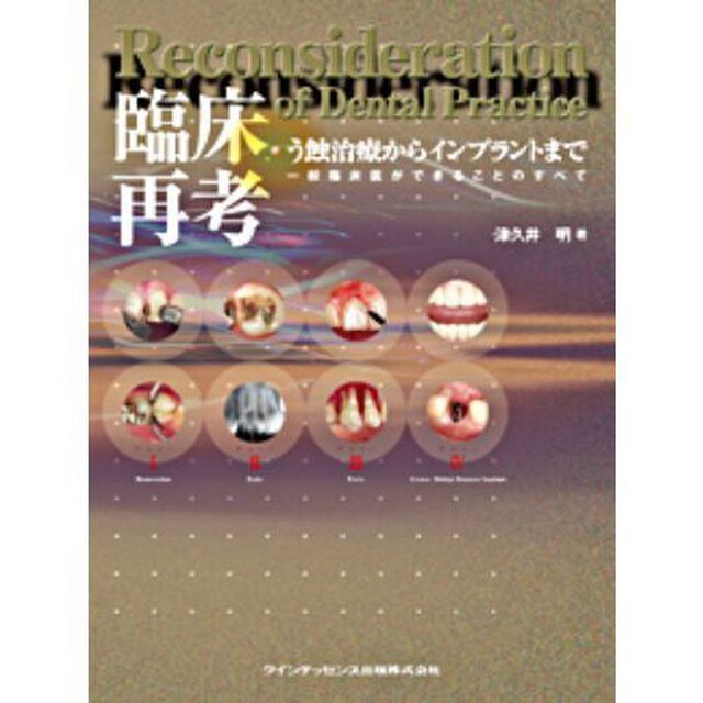 臨床再考・う蝕治療からインプラントまで　一般臨床医ができることのすべて