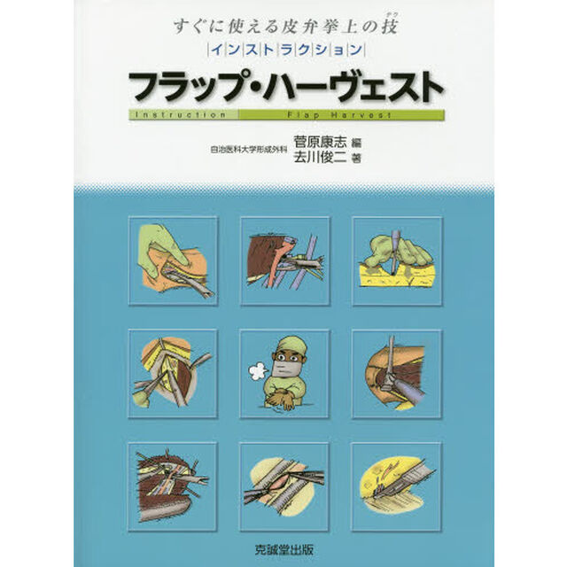 インストラクション・フラップ・ハーヴェスト　すぐに使える皮弁挙上の技