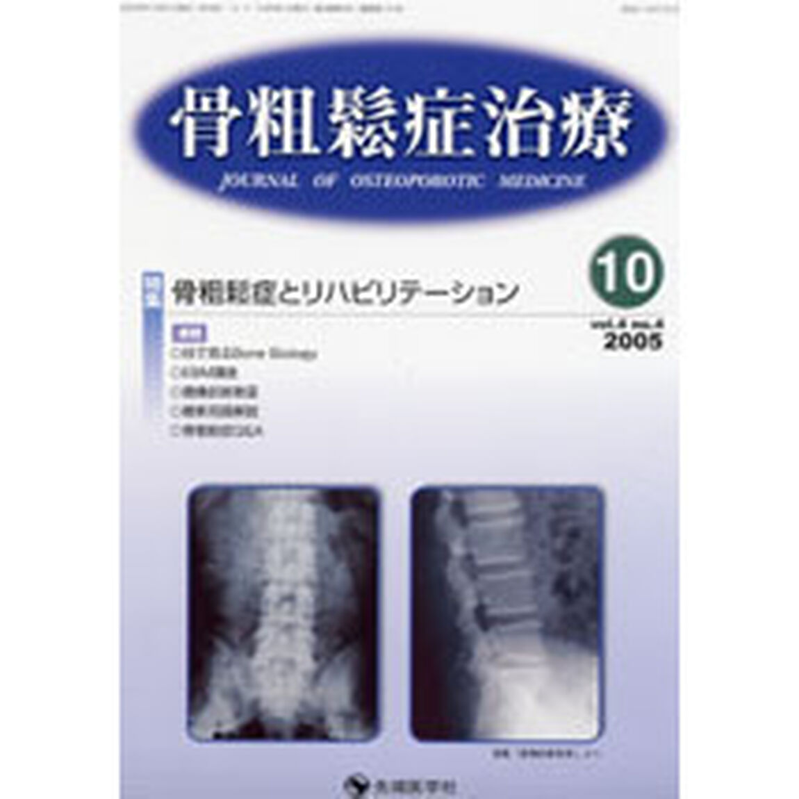 骨粗鬆症治療　Ｖｏｌ．４Ｎｏ．４「特集骨粗鬆症とリハビリテーション」
