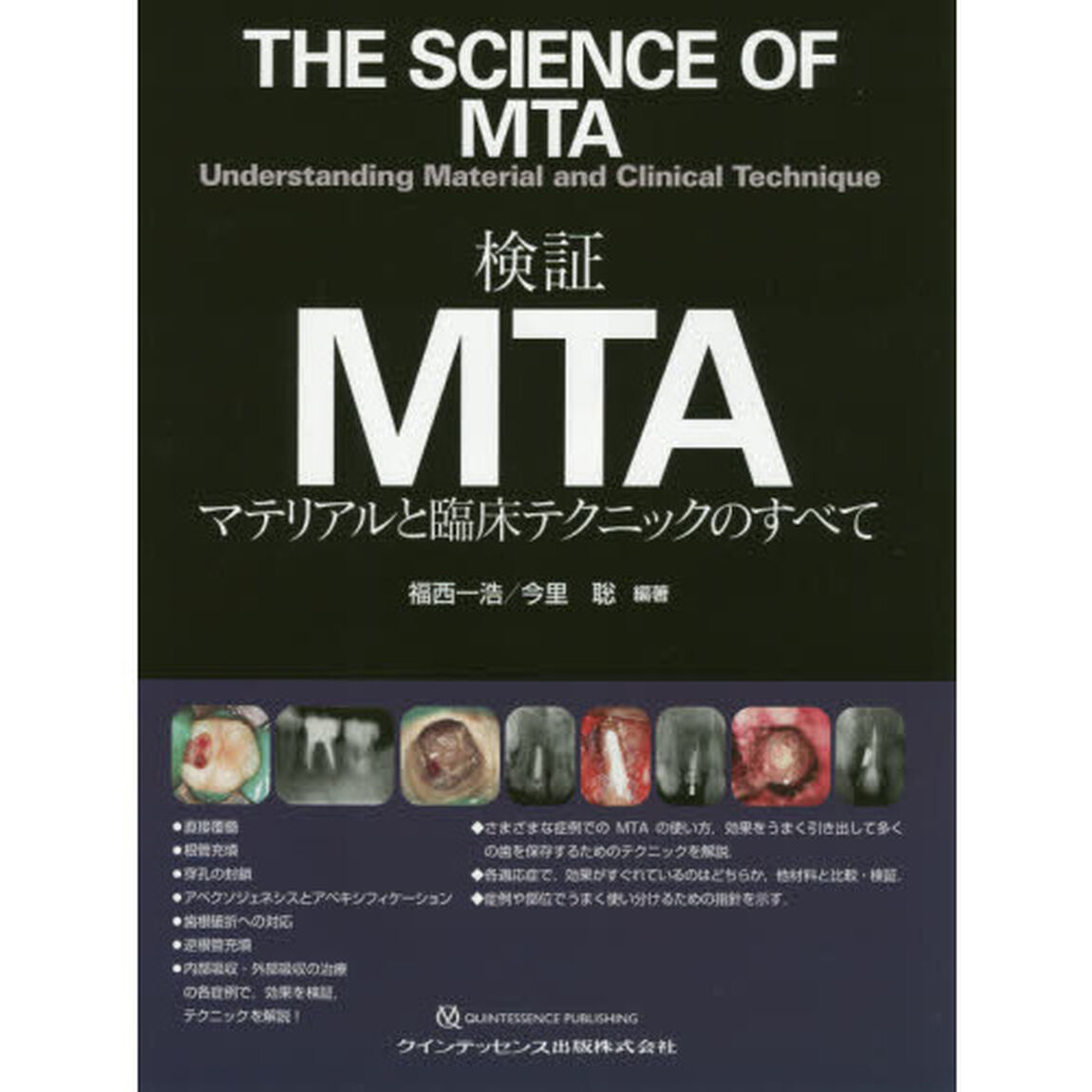 検証ＭＴＡ　マテリアルと臨床テクニックのすべて