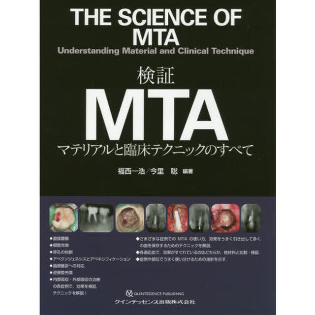 検証ＭＴＡ　マテリアルと臨床テクニックのすべて