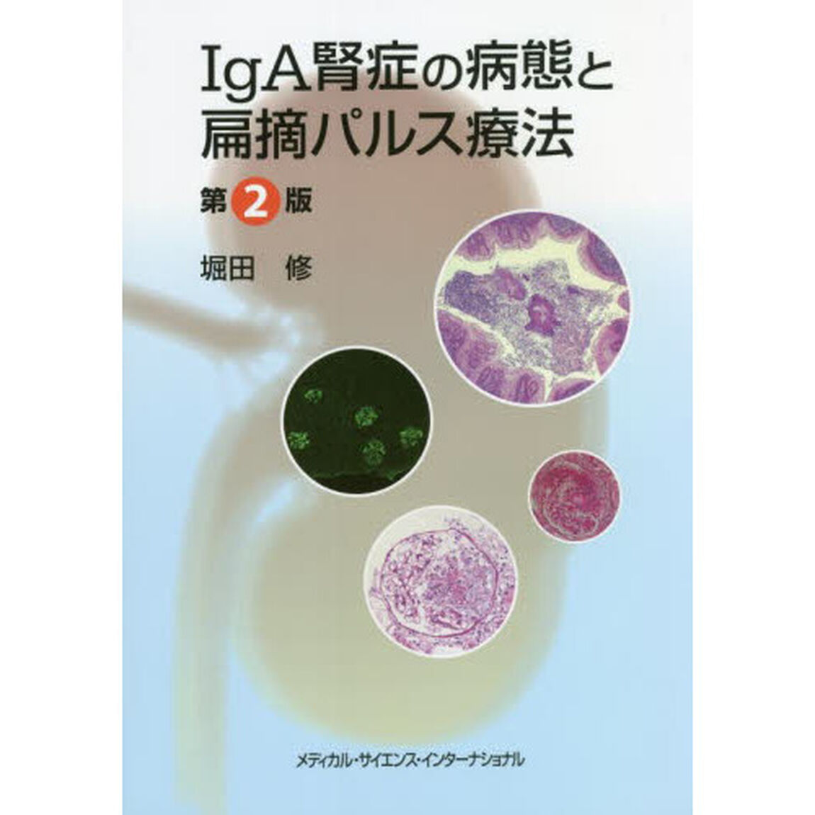 ＩｇＡ腎症の病態と扁摘パルス療法「第２版」