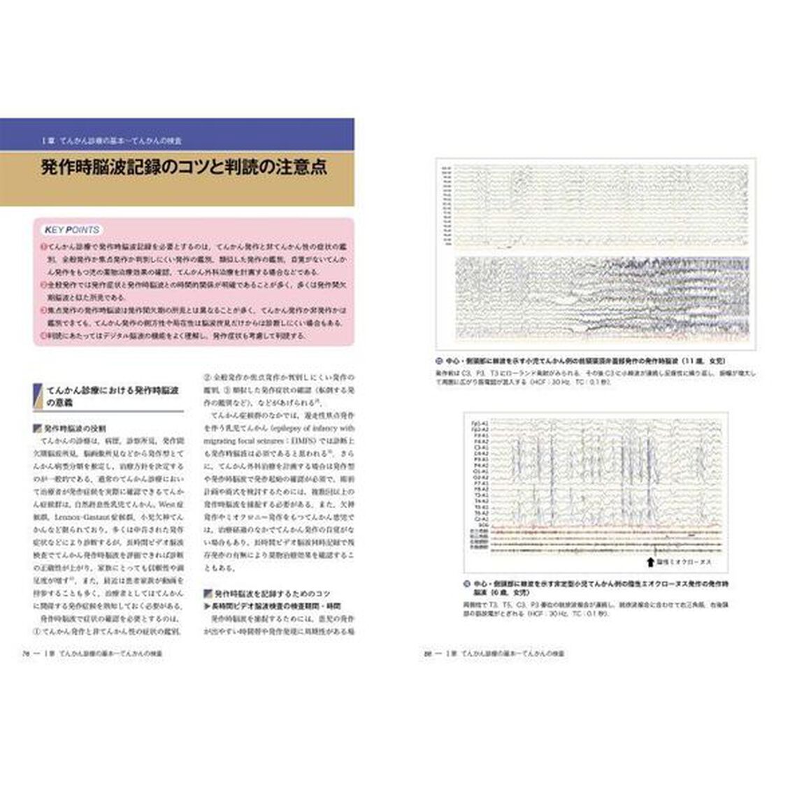 新分類・新薬でわかる小児けいれん・てんかん診療　Ｃｌａｓｓｉｆｉｃａｔｉｏｎ　ａｎｄ　Ｐｒａｃｔｉｃｅ