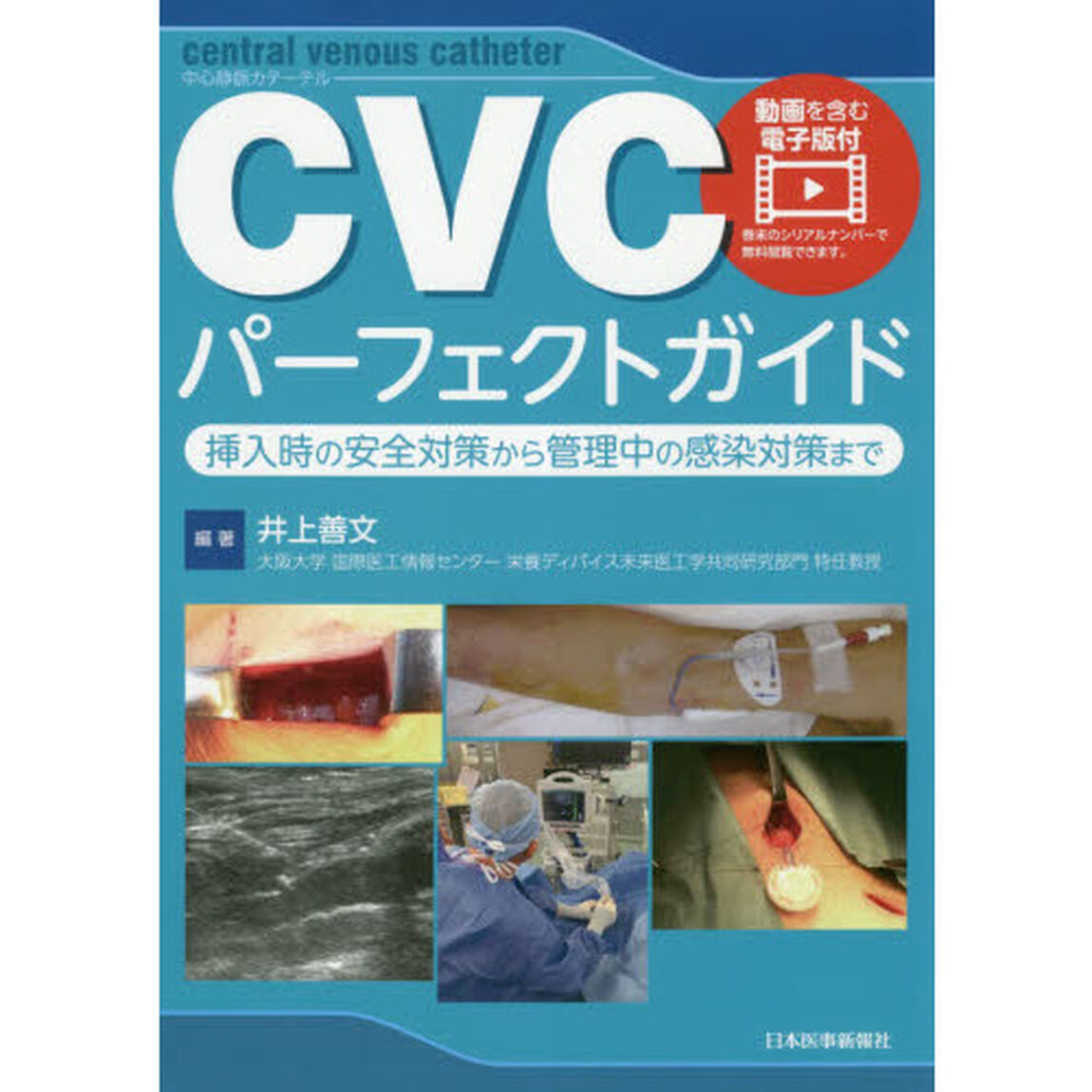 ＣＶＣパーフェクトガイド　挿入時の安全対策から管理中の感染対策まで