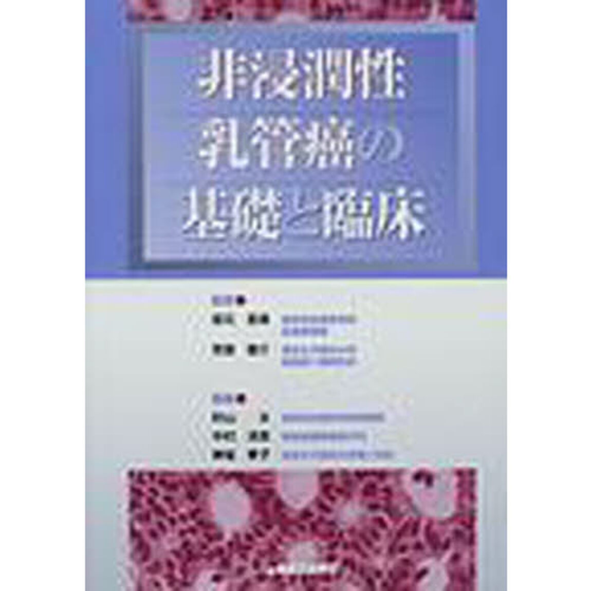非浸潤性乳管癌の基礎と臨床