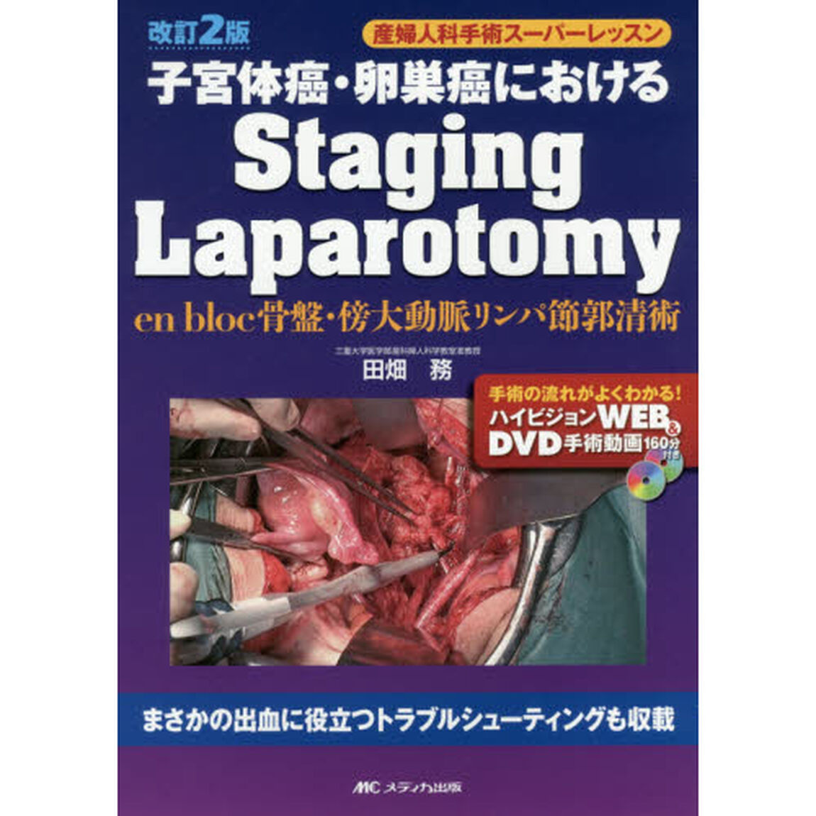 子宮体癌・卵巣癌におけるＳｔａｇｉｎｇ　Ｌａｐａｒｏｔｏｍｙ　ｅｎ　ｂｌｏｃ骨盤・傍大動脈リンパ節郭清術「改訂２版」