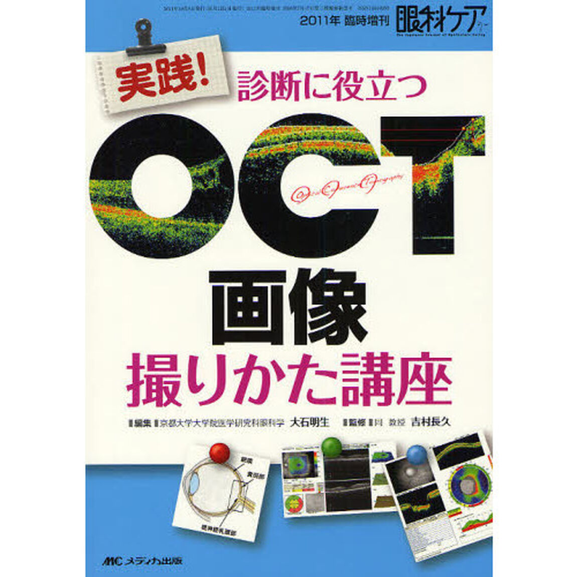 実践！診断に役立つＯＣＴ画像撮りかた講座