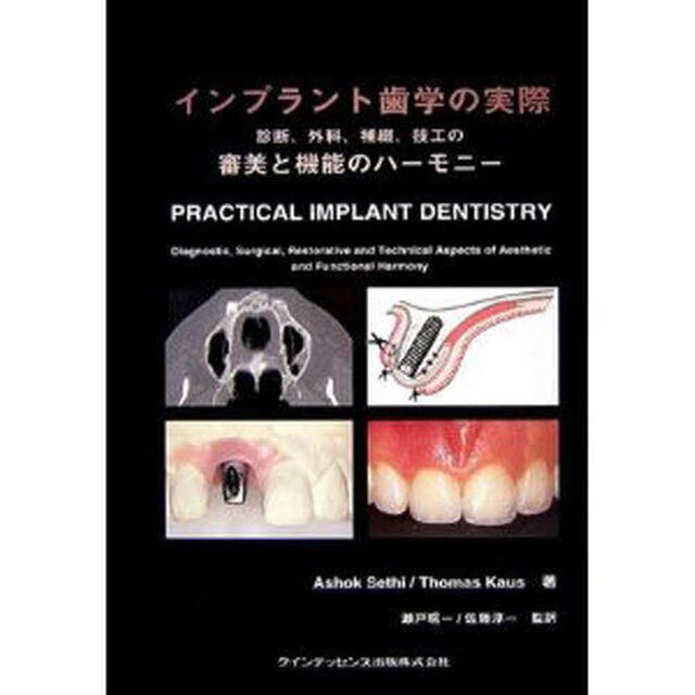 インプラント歯学の実際「診断、外科、補綴、技工の審美と機能のハーモニー」