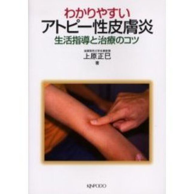 わかりやすいアトピー性皮膚炎　生活指導と治療のコツ