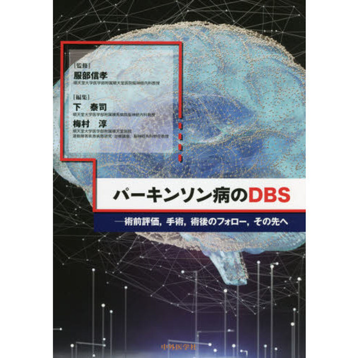 パーキンソン病のＤＢＳ　術前評価，手術，術後のフォロー，その先へ