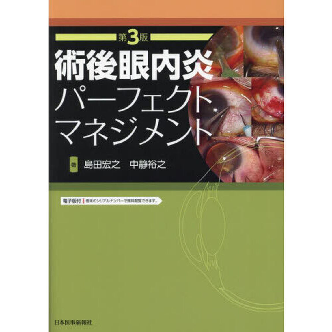 術後眼内炎パーフェクトマネジメント「第３版」