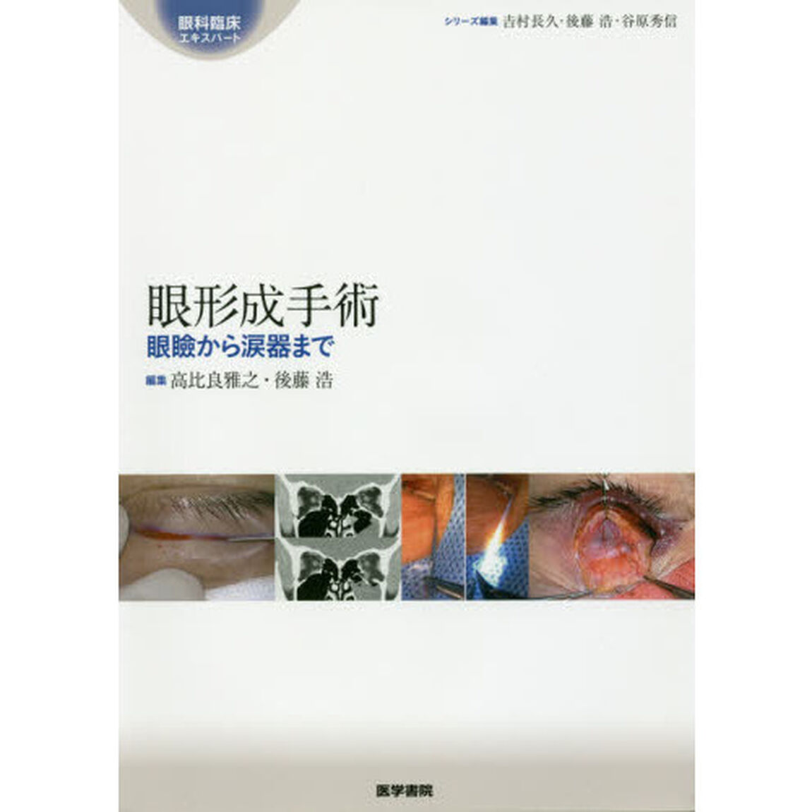 眼形成手術　眼瞼から涙器まで