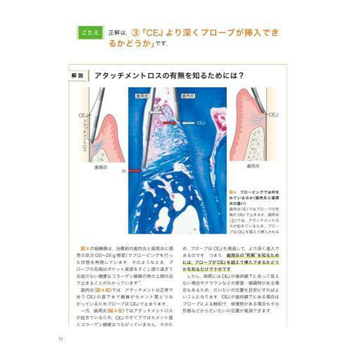 考える歯科衛生士のための歯周治療レッスンブック「新版」